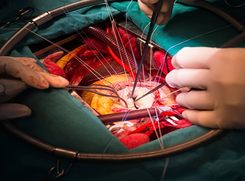 Inside the Digital OR: How AI is Changing the Way Surgeons Operate